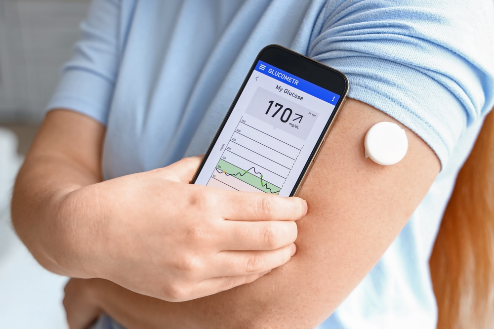CGM Device